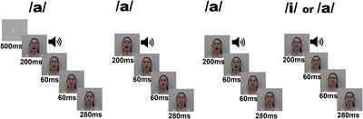 Impact of brain overgrowth on sensorial learning processing during the first year of life